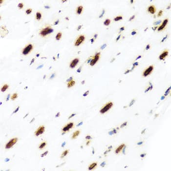 Polyclonal Rabbit anti-Human H2AFX / H2AX Antibody (IHC, IF, WB)