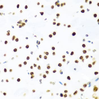 Polyclonal Rabbit anti-Human H2AFX / H2AX Antibody (IHC, IF, WB)