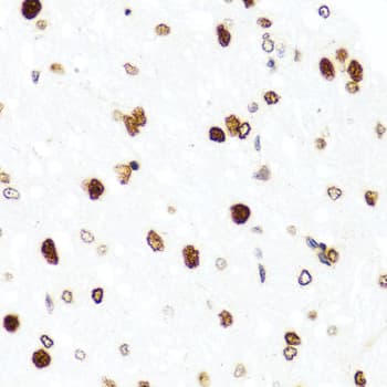 Polyclonal Rabbit anti-Human H2AFX / H2AX Antibody (IHC, IF, WB)