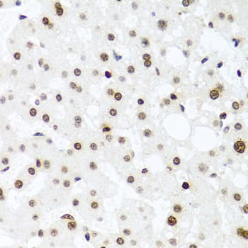 Polyclonal Rabbit anti-Human H2AFX / H2AX Antibody (IHC, IF, WB)