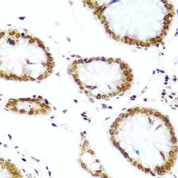 Polyclonal Rabbit anti-Human H2AFX / H2AX Antibody (IHC, IF, WB)