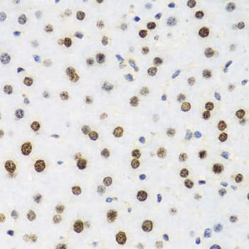 Polyclonal Rabbit anti-Human H2AFX / H2AX Antibody (IHC, IF, WB)