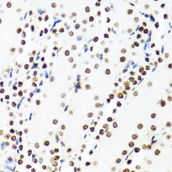 Polyclonal Rabbit anti-Human H2AFX / H2AX Antibody (IHC, IF, WB)