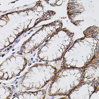 Polyclonal Rabbit anti-Human MMP9 / Gelatinase B Antibody (IHC, WB)