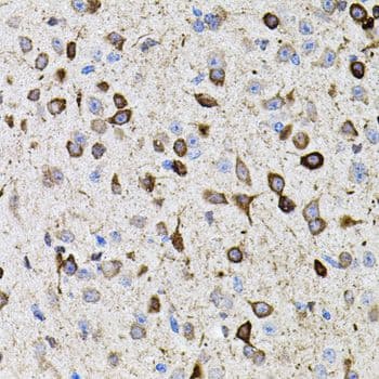 Polyclonal Rabbit anti-Human MMP9 / Gelatinase B Antibody (IHC, WB)