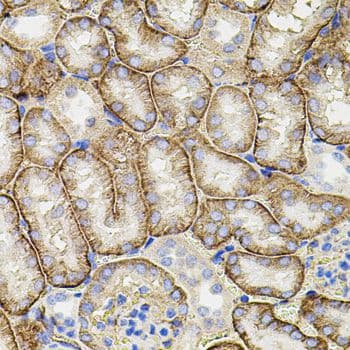 Polyclonal Rabbit anti-Human MMP9 / Gelatinase B Antibody (IHC, WB)