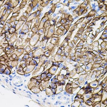 Polyclonal Rabbit anti-Human MMP9 / Gelatinase B Antibody (IHC, WB)