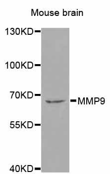 Polyclonal Rabbit anti-Human MMP9 / Gelatinase B Antibody (IHC, WB)