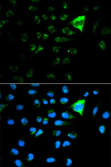 Polyclonal Rabbit anti-Human CDKN1A / WAF1 / p21 Antibody (IHC, IF)