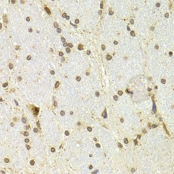 Polyclonal Rabbit anti-Human CDKN1A / WAF1 / p21 Antibody (IHC, IF)