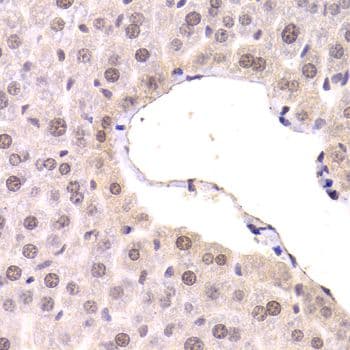 Polyclonal Rabbit anti-Human CDKN1A / WAF1 / p21 Antibody (IHC, IF)