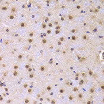 Polyclonal Rabbit anti-Human CDKN1A / WAF1 / p21 Antibody (IHC, IF)