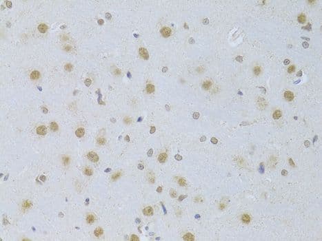 Polyclonal Rabbit anti-Human CDKN1A / WAF1 / p21 Antibody (IHC, IF)