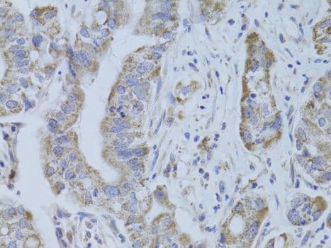 Polyclonal Rabbit anti-Human CDKN1A / WAF1 / p21 Antibody (IHC, IF)