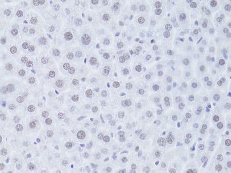 Polyclonal Rabbit anti-Human CDKN1A / WAF1 / p21 Antibody (IHC, IF)