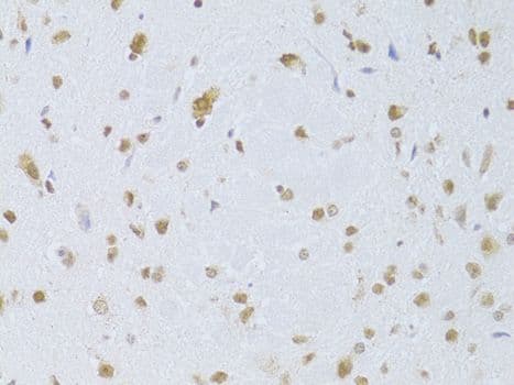 Polyclonal Rabbit anti-Human CDKN1A / WAF1 / p21 Antibody (IHC, IF)