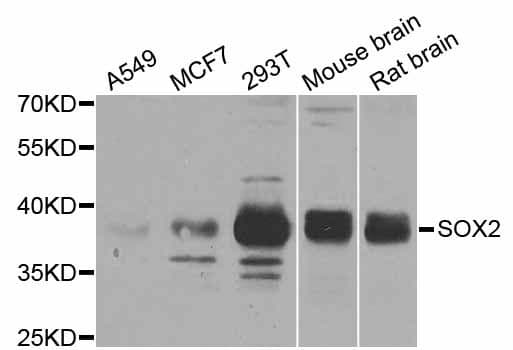 Polyclonal Rabbit anti-Human SOX2 Antibody (WB)