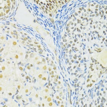 BRCA1 Antibody