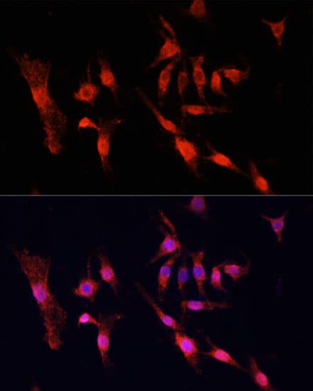 EGFR Antibody