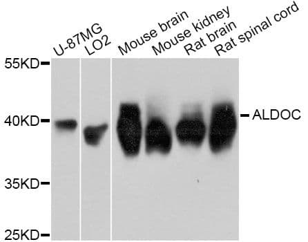 Polyclonal Rabbit anti-Human ALDOC / Aldolase C Antibody (WB)