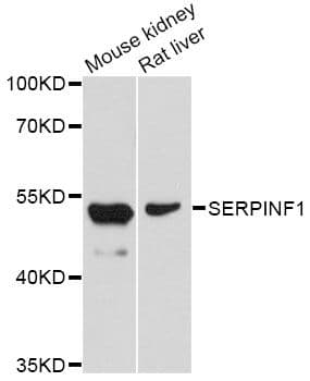 Polyclonal Rabbit anti-Human SERPINF1 / PEDF Antibody (WB)
