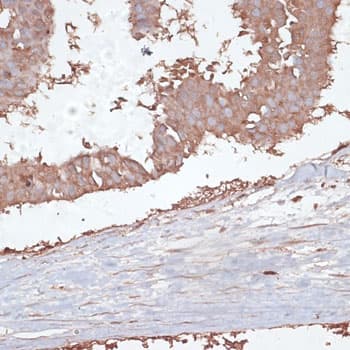 TGFBR2 Antibody