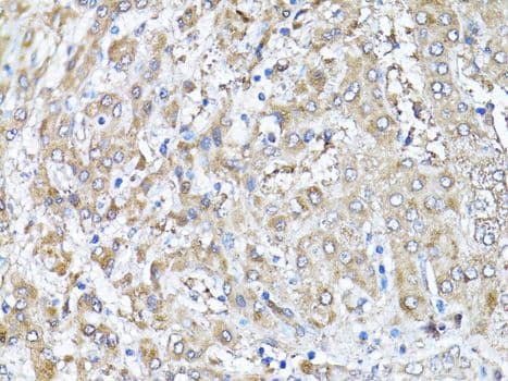 Polyclonal Rabbit anti-Human SNAI1 / SNAIL-1 Antibody (IHC, WB)