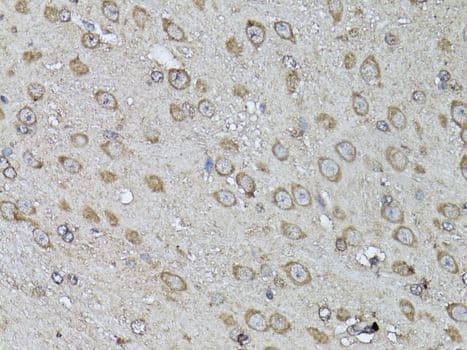 Polyclonal Rabbit anti-Human SNAI1 / SNAIL-1 Antibody (IHC, WB)