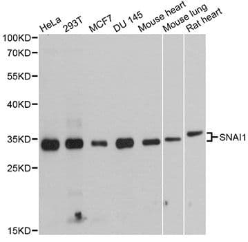 Polyclonal Rabbit anti-Human SNAI1 / SNAIL-1 Antibody (IHC, WB)