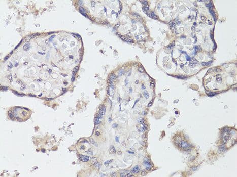 Polyclonal Rabbit anti-Human NTRK2 / TRKB Antibody (IHC, WB)