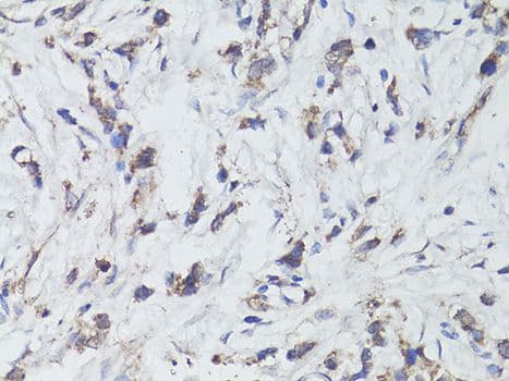 Polyclonal Rabbit anti-Human NTRK2 / TRKB Antibody (IHC, WB)