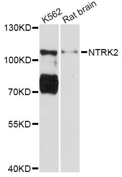 Polyclonal Rabbit anti-Human NTRK2 / TRKB Antibody (IHC, WB)