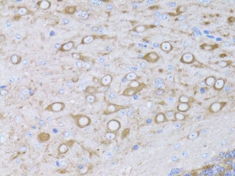 MYH10 Antibody