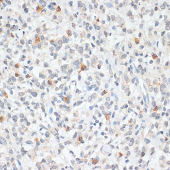 Polyclonal Rabbit anti-Human FOXP3 Antibody (IHC, WB)