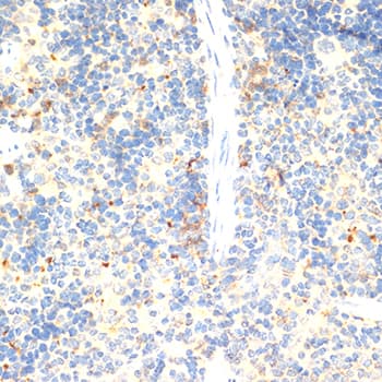 Polyclonal Rabbit anti-Human FOXP3 Antibody (IHC, WB)