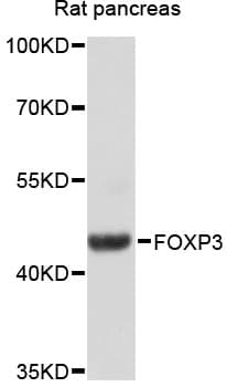 Polyclonal Rabbit anti-Human FOXP3 Antibody (IHC, WB)