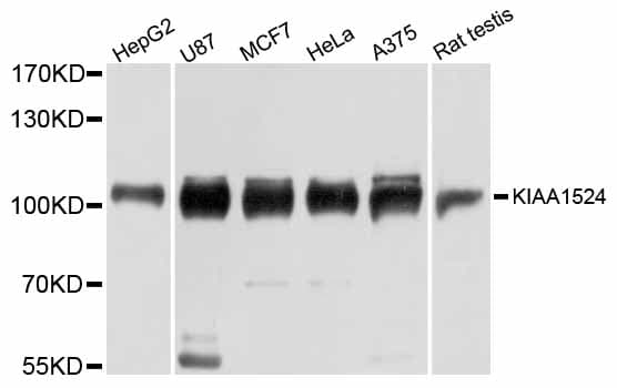 Polyclonal Rabbit anti-Human KIAA1524 / p90 Autoantigen Antibody (IHC, WB)