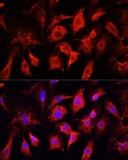 Polyclonal Rabbit anti-Human ENO2 / NSE Antibody (IF, WB)