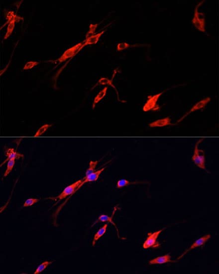 Polyclonal Rabbit anti-Human ENO2 / NSE Antibody (IF, WB)