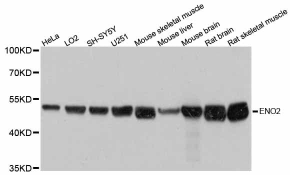 Polyclonal Rabbit anti-Human ENO2 / NSE Antibody (IF, WB)