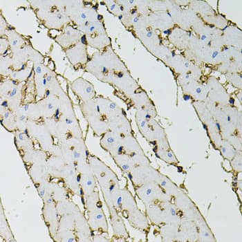 Polyclonal Rabbit anti-Human ANXA2 / Annexin A2 Antibody (IHC, IF, WB)