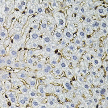 Polyclonal Rabbit anti-Human ANXA2 / Annexin A2 Antibody (IHC, IF, WB)