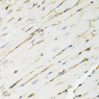 Polyclonal Rabbit anti-Human ANXA2 / Annexin A2 Antibody (IHC, IF, WB)