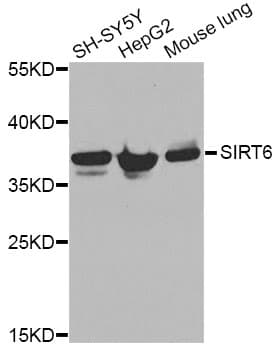 Polyclonal Rabbit anti-Human ANXA2 / Annexin A2 Antibody (IHC, IF, WB)