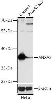 Polyclonal Rabbit anti-Human ANXA2 / Annexin A2 Antibody (IHC, IF, WB)