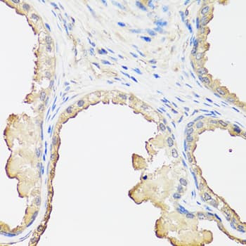 Polyclonal Rabbit anti-Human B2M / Beta 2 Microglobulin Antibody (IHC, WB)