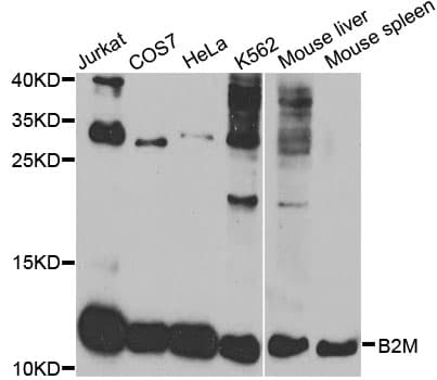Polyclonal Rabbit anti-Human B2M / Beta 2 Microglobulin Antibody (IHC, WB)