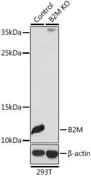 Polyclonal Rabbit anti-Human B2M / Beta 2 Microglobulin Antibody (IHC, WB)