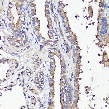 Polyclonal Rabbit anti-Human CD44 Antibody (IHC, IF, WB)