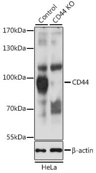 Polyclonal Rabbit anti-Human CD44 Antibody (IHC, IF, WB)